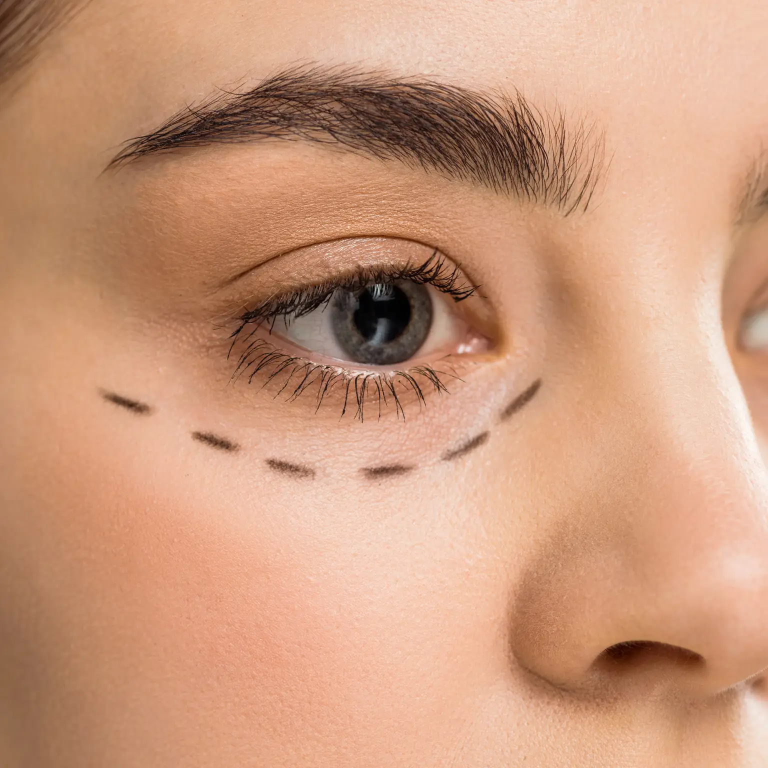 Facial Rejuvenation